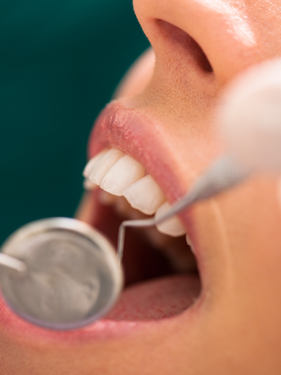 Periodontal Maintenance in Yuma, AZ